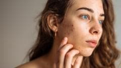 The simple skincare routine for teens that actually works - and five expert tips